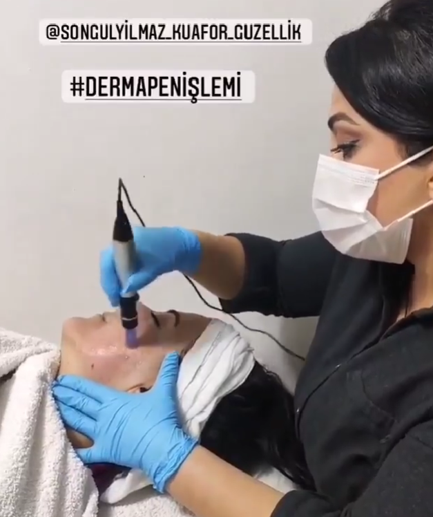 Dermapen